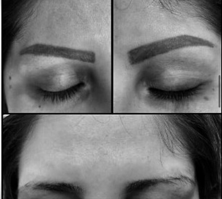 Fjernelse af permanent makeup sort/hvid